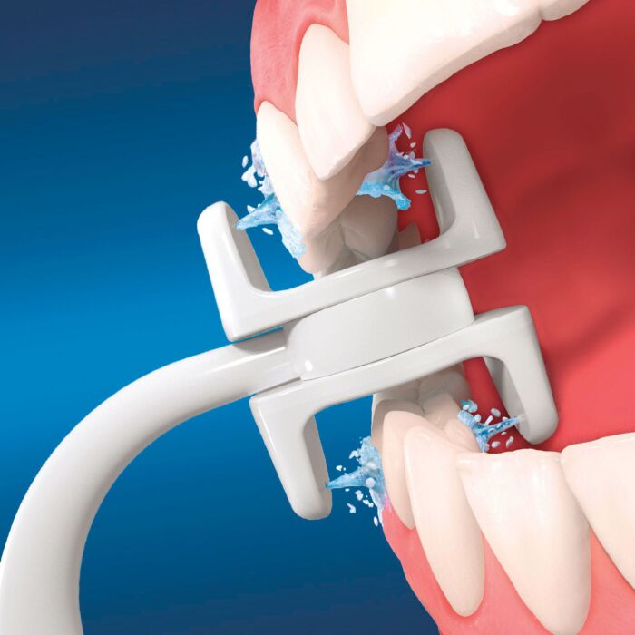 CorpCare Miracle Smile, hydropulseur électrique