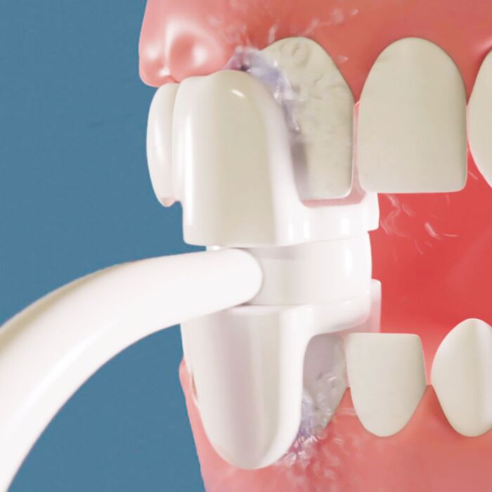 CorpCare Miracle Smile, hydropulseur électrique