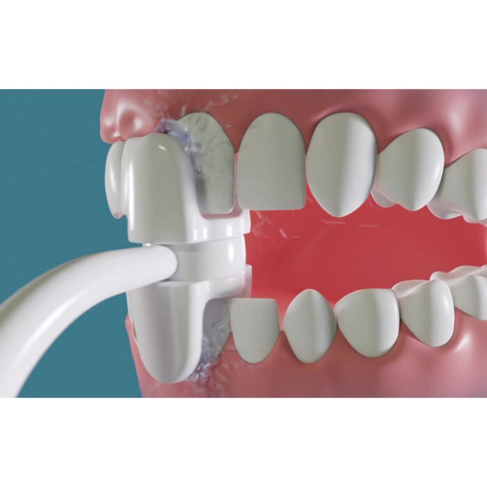 CorpCare Miracle Smile, hydropulseur électrique