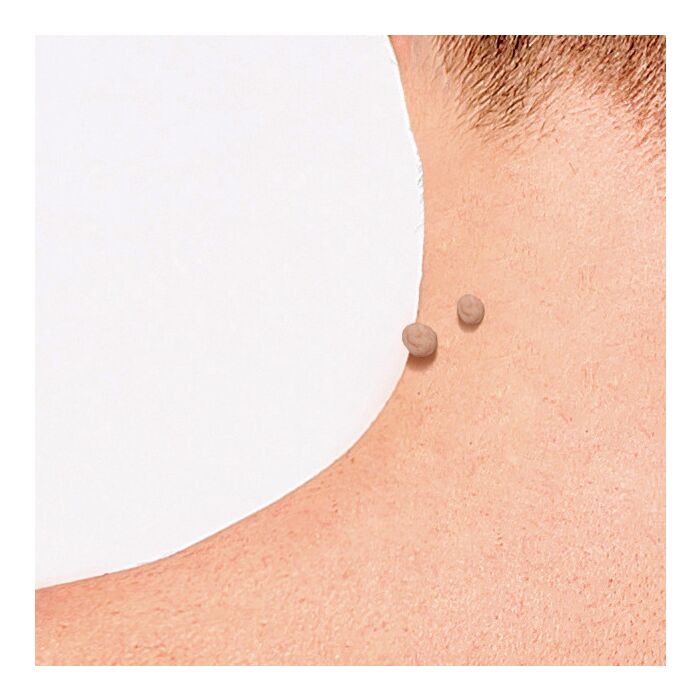 Patchs pour verrues Formuclear Skin Tag Patch, 30 pièces