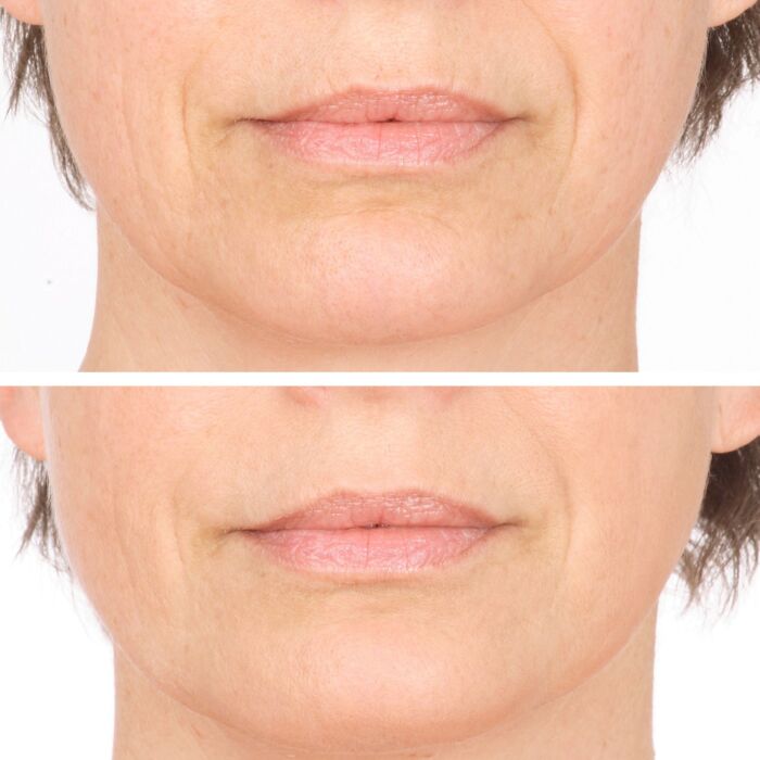 Vitame Collagen Plus gélules, raffermissement et hydratation de la peau, 90 pièces