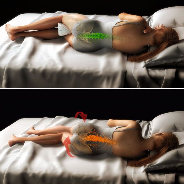 Restform Leg Pillow MD Beinkissen, druckentlastender Memory-Schaum